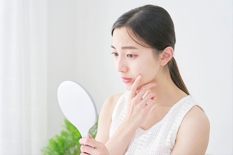 皮膚疾患で悩む女性